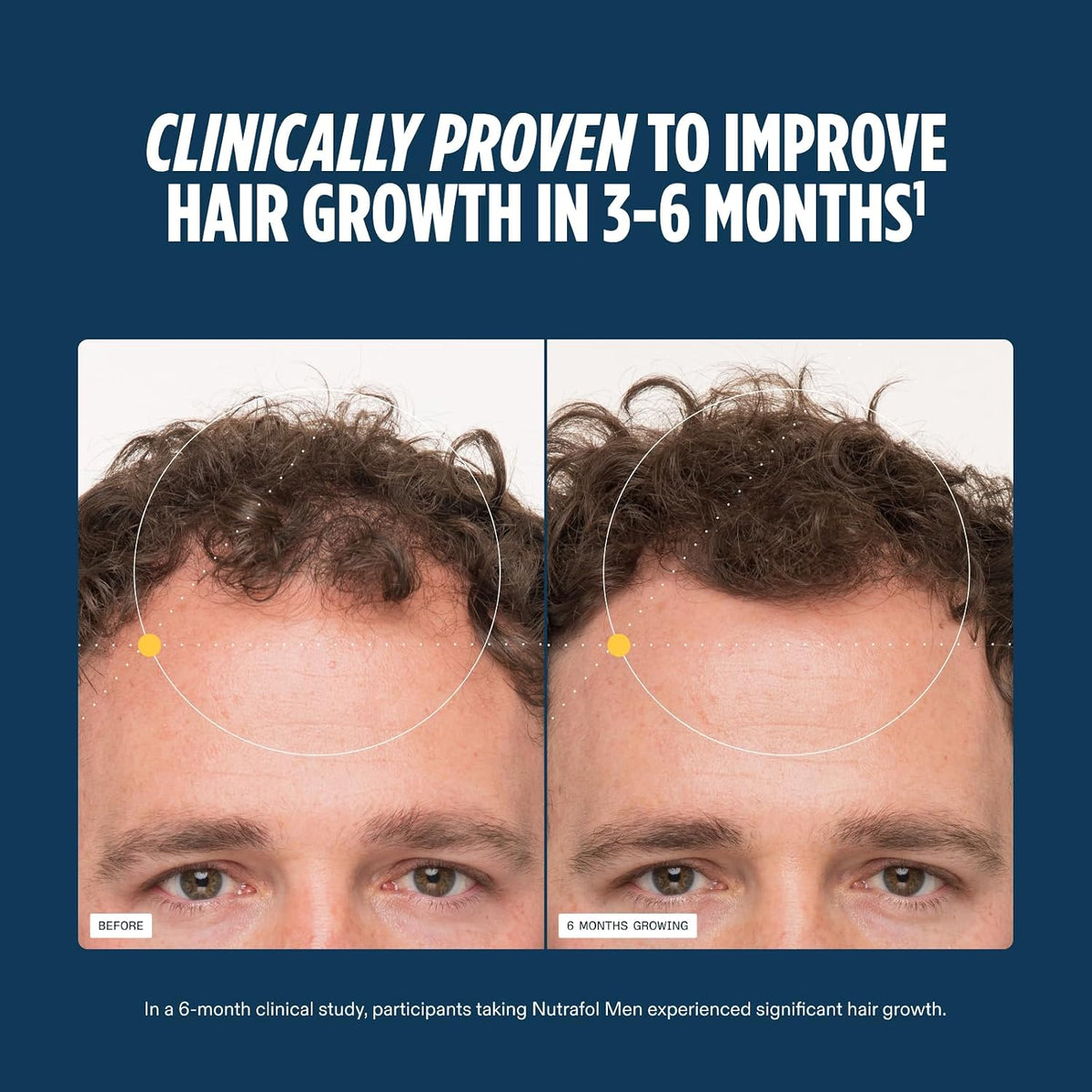 Nutrafol Men Hair Growth Supplements, Ages 18-49 , 120 capsules  ( pack of 3 )